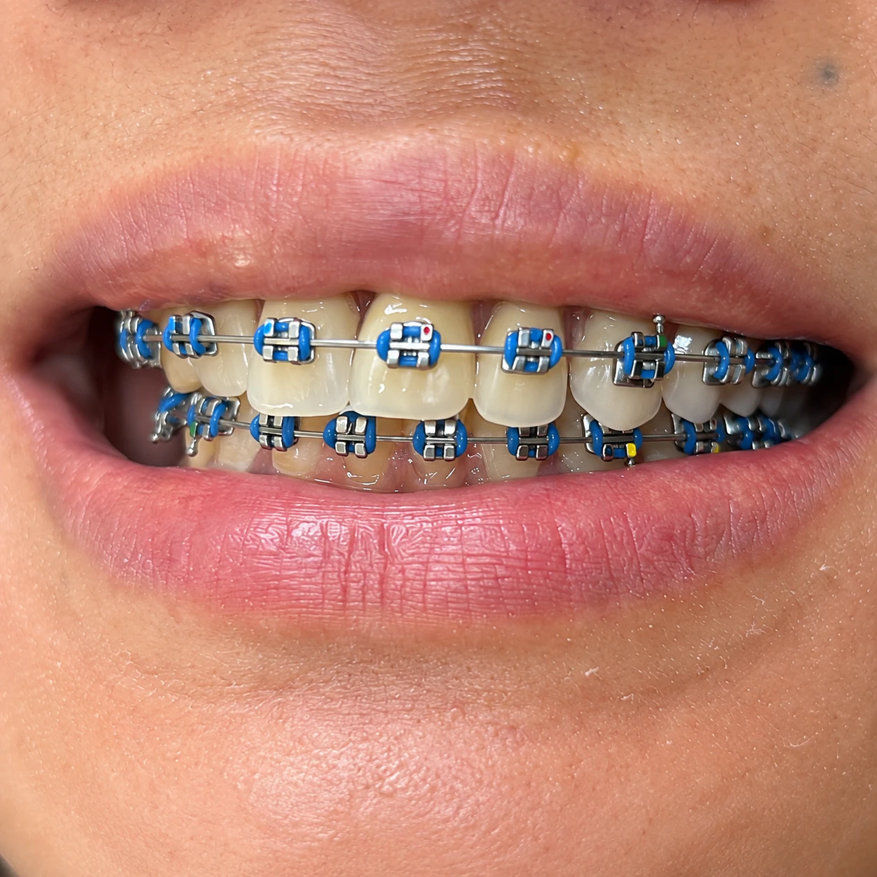 Case 01 after treatment